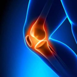Home Remedies for Joints Pain